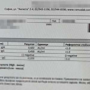 Teste false pentru depistarea virusului SARS-COV-2, descoperite în P.T.F. Giurgiu
