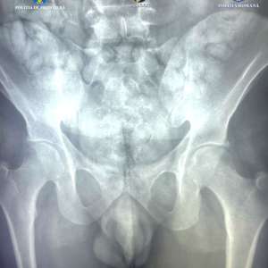 Cetățean brazilian arestat preventiv după ce a fost depistat pe Aeroportul Otopeni cu droguri asupra sa