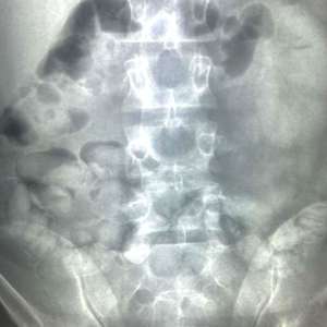 Cetățean brazilian arestat preventiv după ce a fost depistat pe Aeroportul Otopeni cu droguri asupra sa